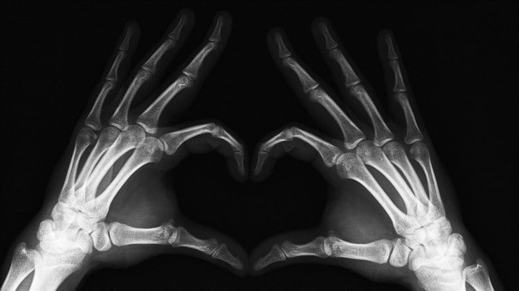 X Ray Hands