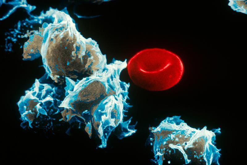 Amazing Medical Advances Leukemia Cells