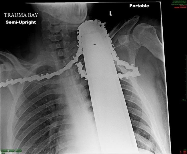 weirdest x-rays chainsaw
