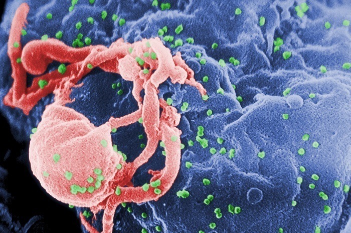 HIV AIDS Microscope Budding