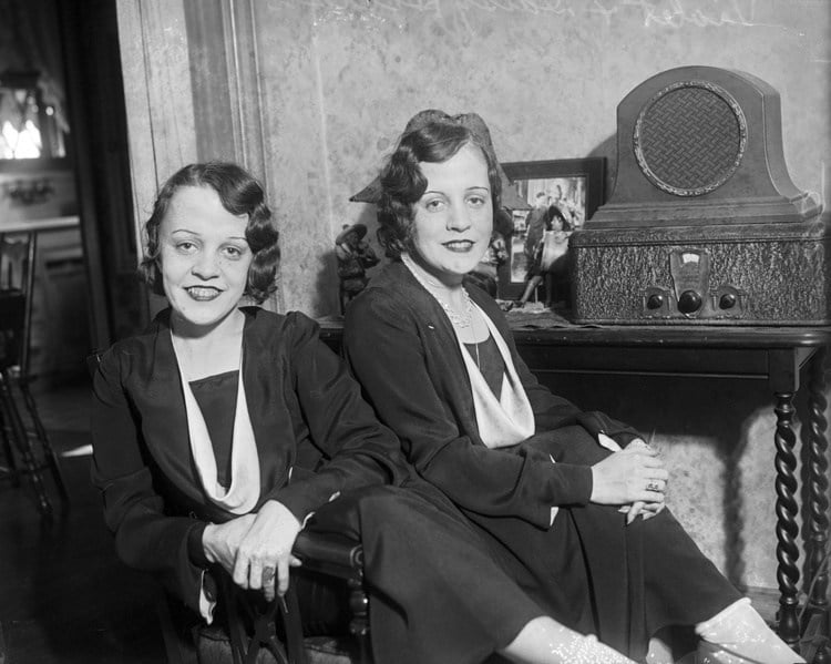 hilton conjoined sisters radio