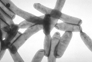 Legionnaires Disease Image