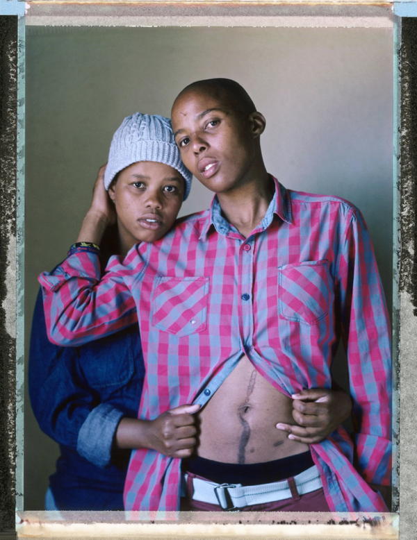 Gay Woman Stab Wound