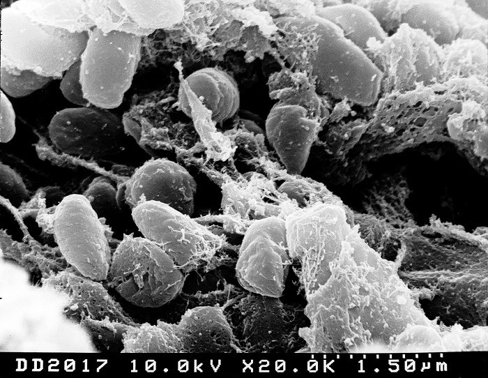 Plague Bacteria