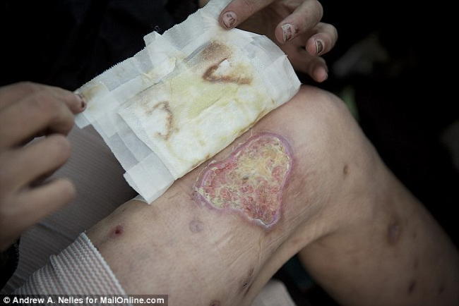 Krokodil Thigh Flesh