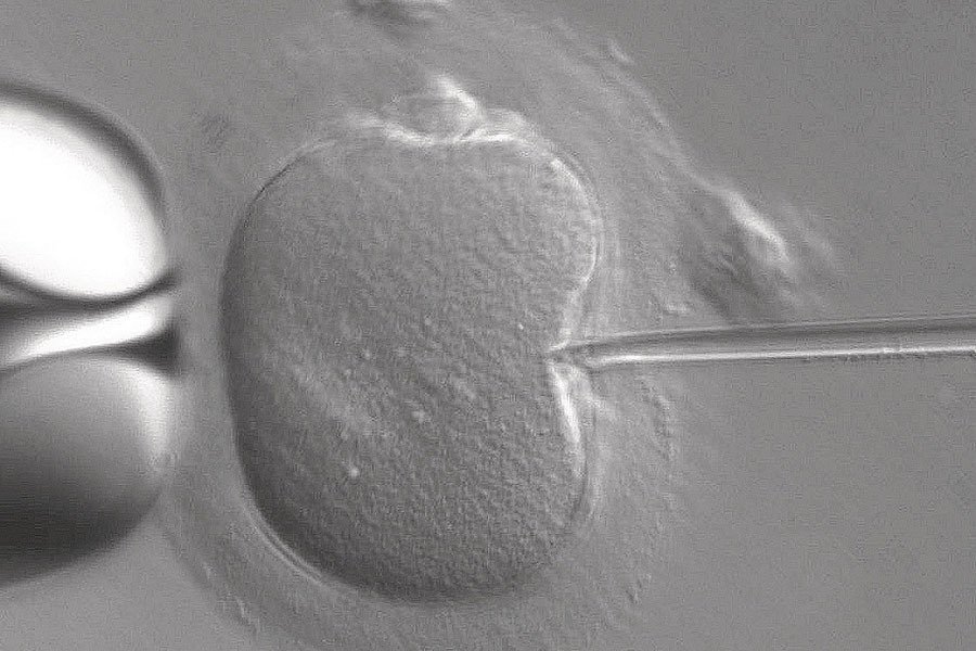 Scientific Discoveries 2015 IVF