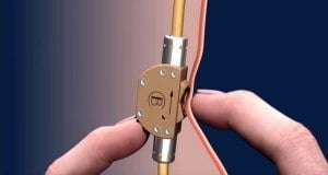 Bimek Sperm Switch Og