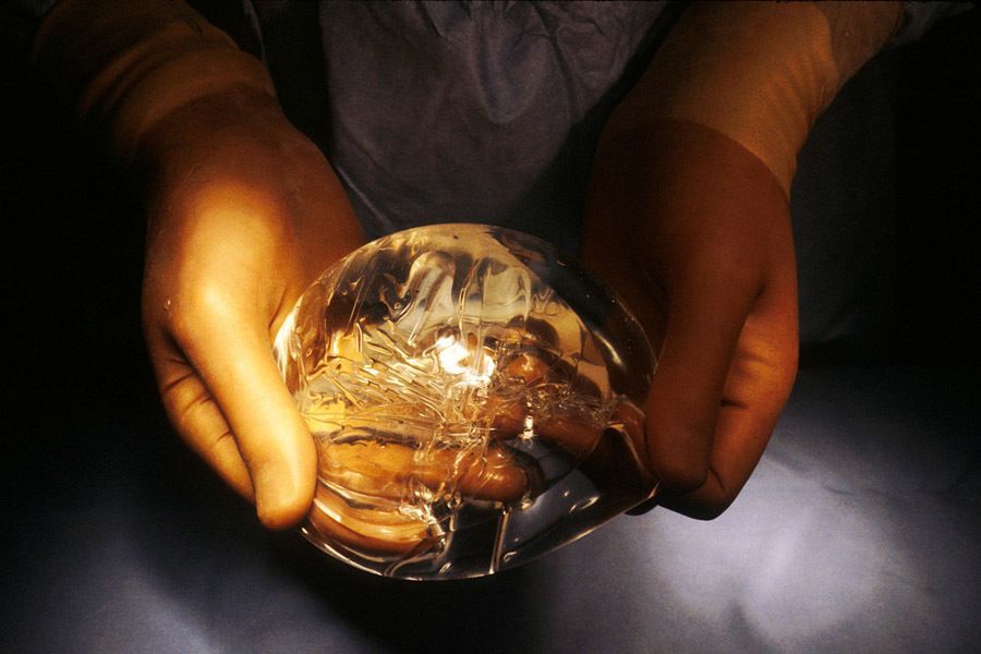 History Of Breast Implants