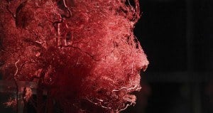 Unusual Disorders Brain Body System