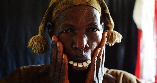 Witch Doctor Teeth