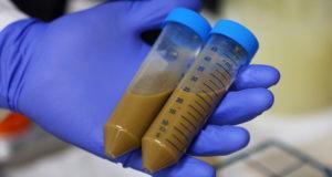 Poop Transplant Vials Hand