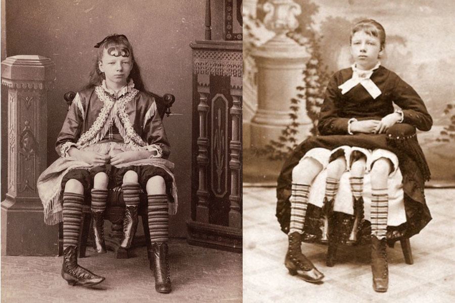 Freak Show Performer Myrtle Corbin