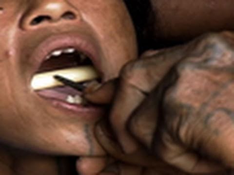 sharpened teeth body modification