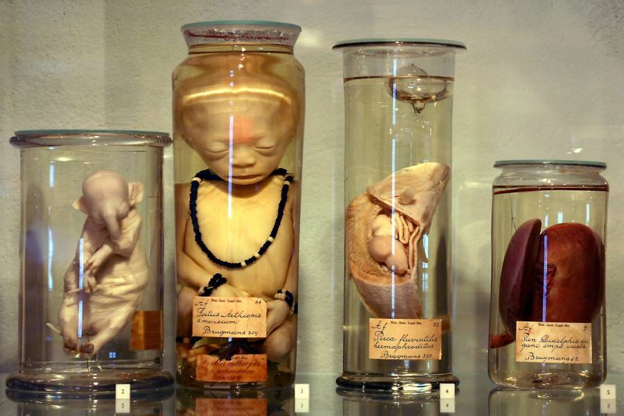 Weird Museums Around The World Gambaran