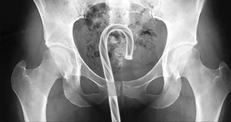 31 Funny X Ray Images That Seem Too Ridiculous To Be Real