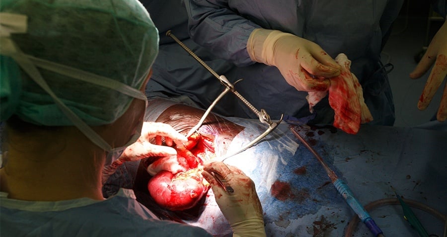 Surgery Organs