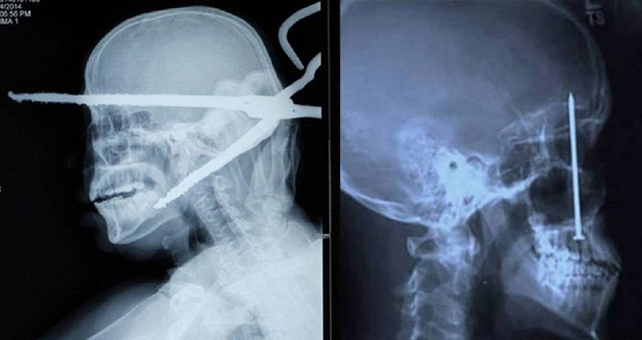 The 31 Most Ridiculous And Funny X-Ray Images You'll Ever See.