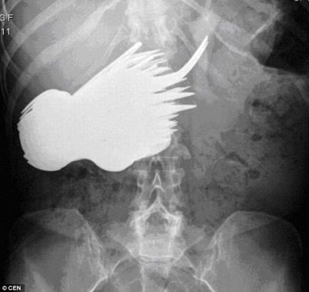 From candy canes to hand grenades, these hilariously weird and funny X-ray ...