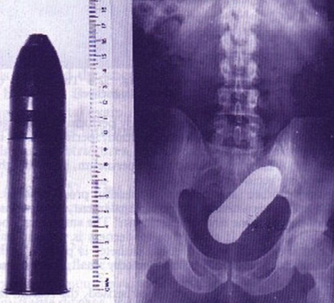 31 Funny X Ray Images That Seem Too Ridiculous To Be Real 4253