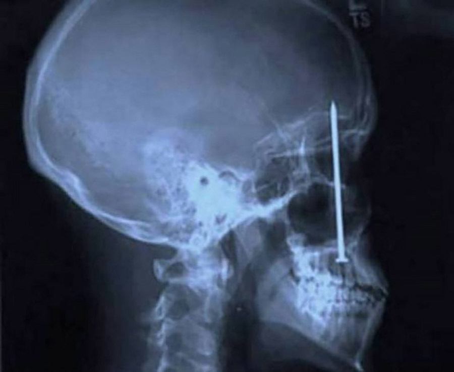 31 Funny X Ray Images That Seem Too Ridiculous To Be Real