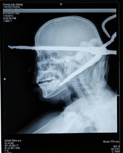 31 Funny X Ray Images That Seem Too Ridiculous To Be Real 