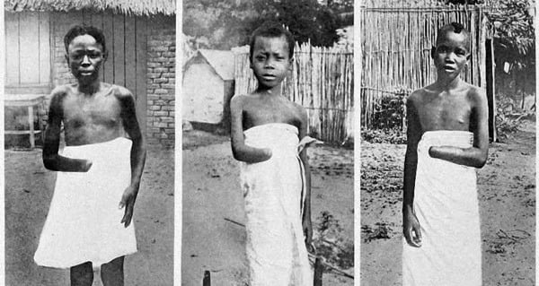 Why King Leopold Ii Should Be Remembered Alongside Hitler