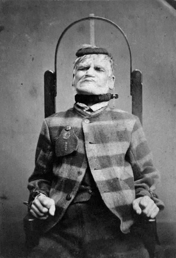 insane asylum treatment methods