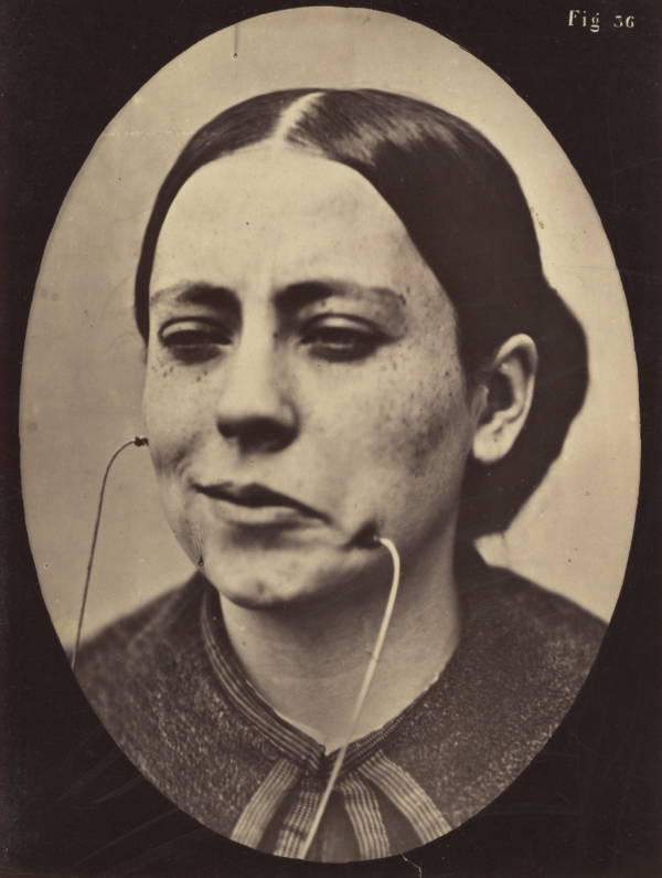 Photos Of Duchenne de Boulogne's Experiments On The Human Face