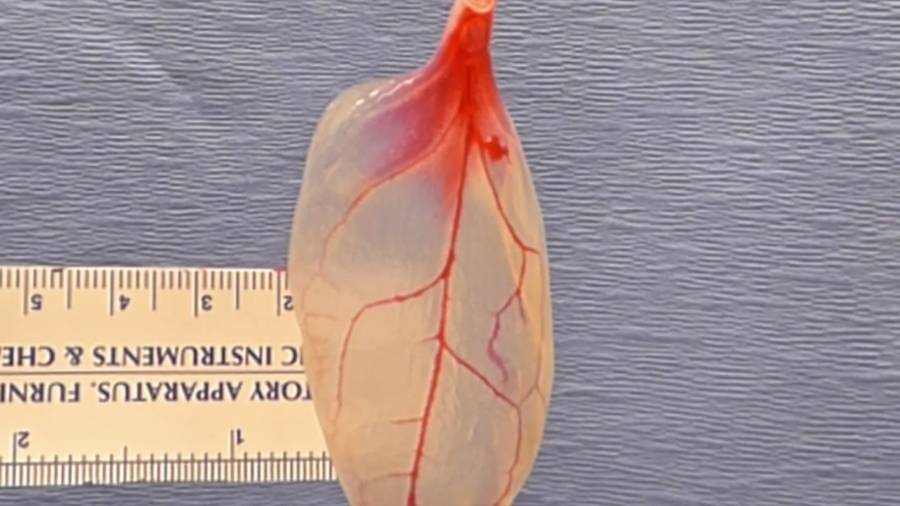 Scientists Turn A Spinach Leaf Into A Mini Beating Heart (VIDEO)