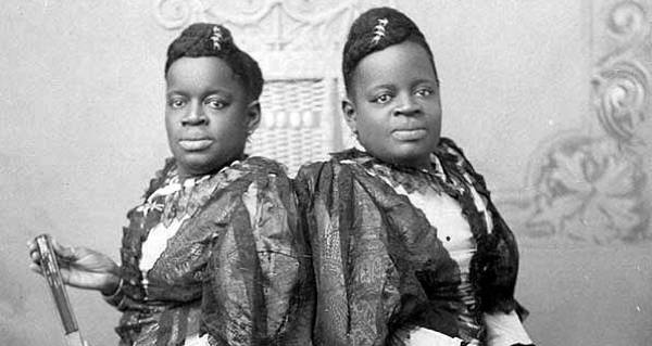 How The Conjoined McCoy Twins Took Back Their Own Destiny