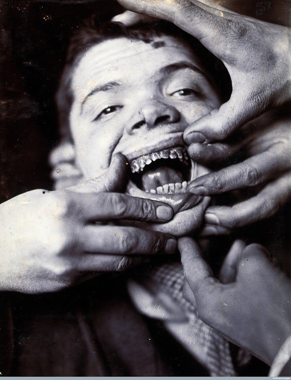 Terrifying Early Dentistry Pictures