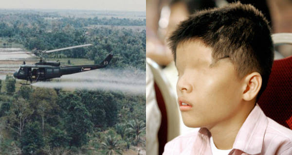 Agent Orange Victims Then And Now In 24 Disturbing Photos