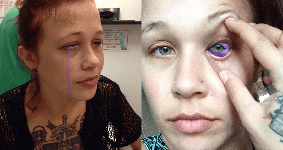 Genius Gets Tattoo On Her Eyeball, Which She Might Now Lose