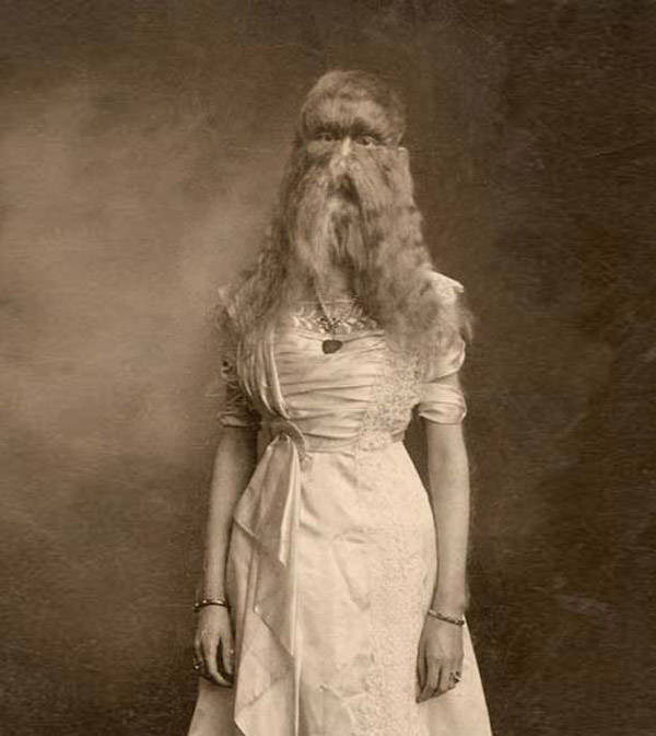 25 Tragic Photos From Freak Shows Of Decades Past