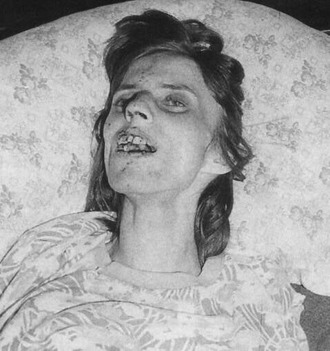 Anneliese Michel Dying