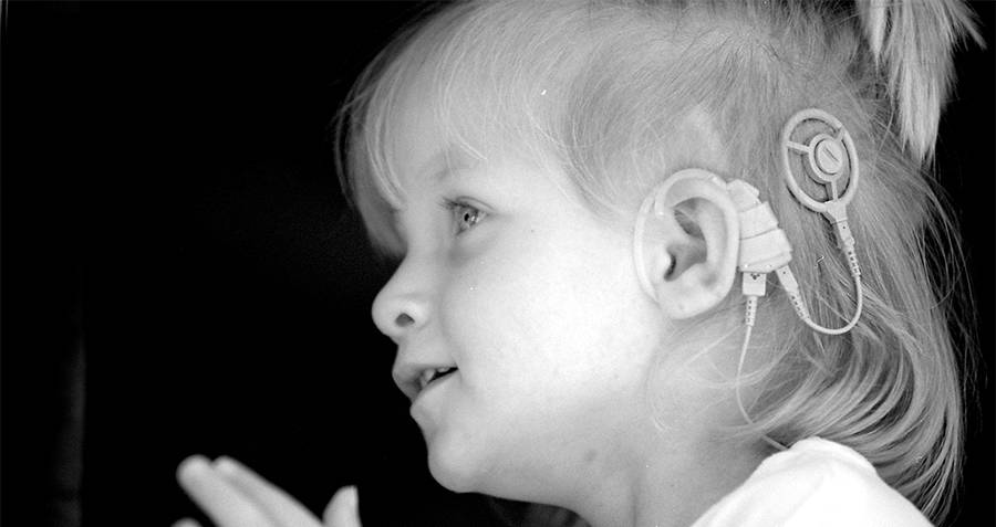 Child with a cochlear implant