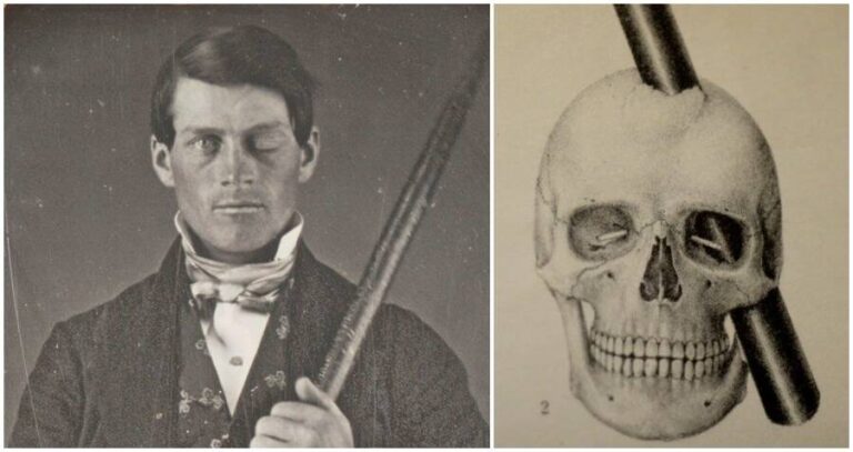 Phineas Gage