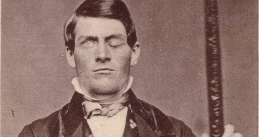 Phineas Gage