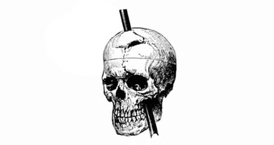 Phineas Gage Illustration