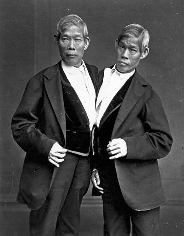 Chang Eng Bunker Siamese Twins