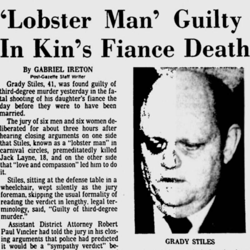 Lobster Boy Interesting Story In Newspaper
