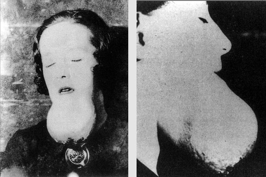 Image result for radium girls