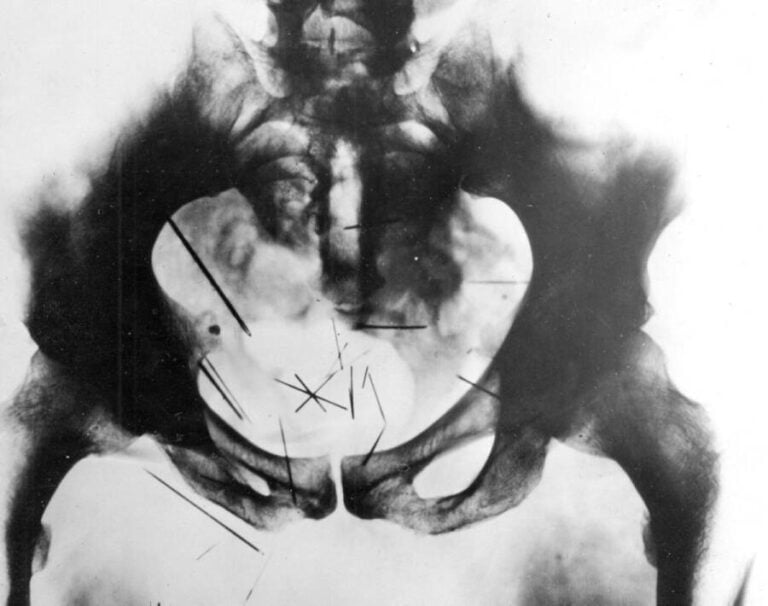 Albert fish the brooklyn vampire who killed and ate children