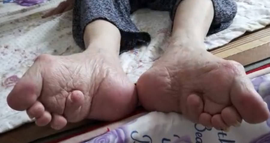 Elderly Chinese Woman With Bound Feet