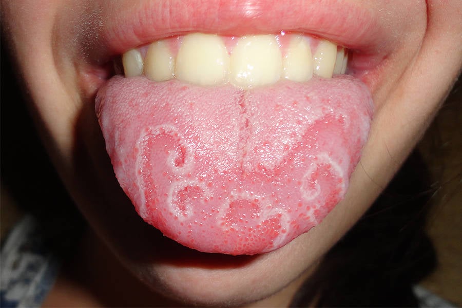 Tongue Print