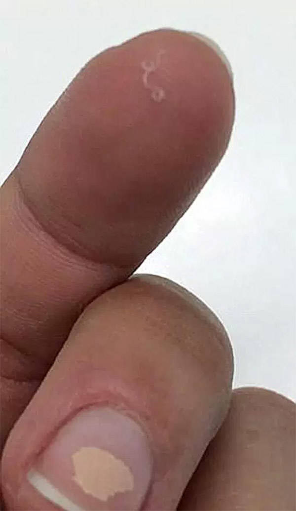 Worm Finger