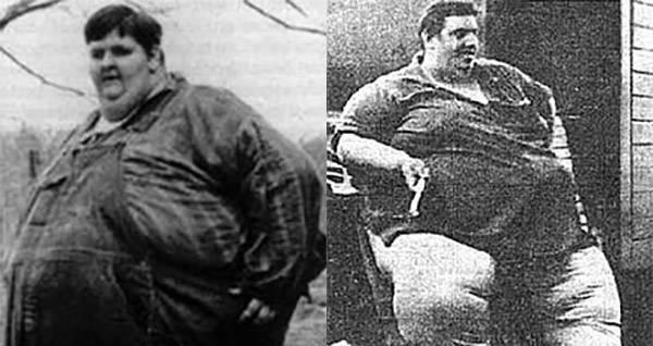 Meet Jon Brower Minnoch The Heaviest Person In The World