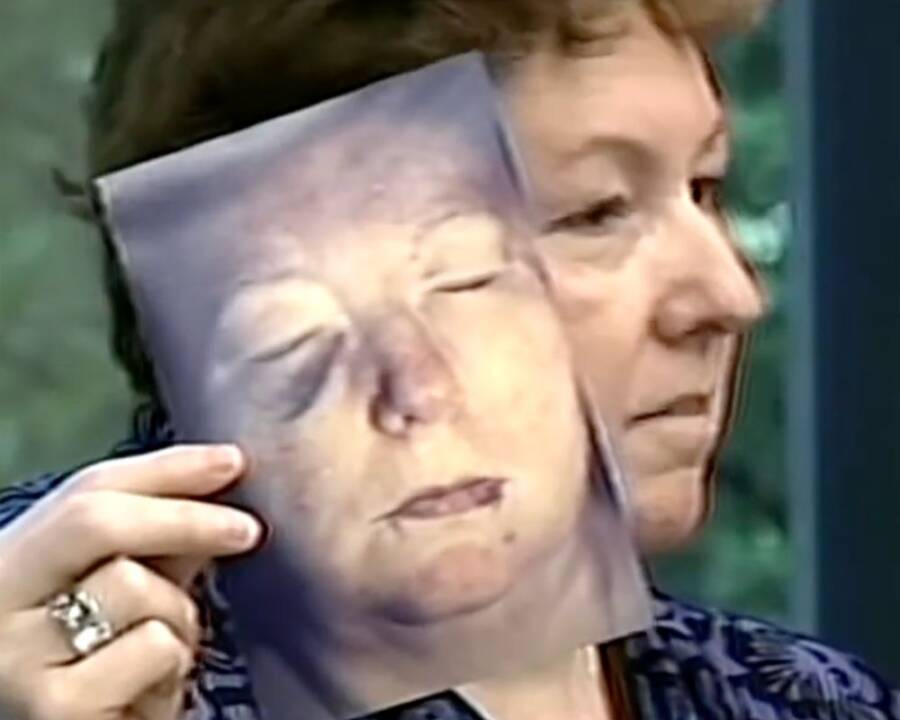 Susan Kuhnhausen's Injuries From Hammer Attack