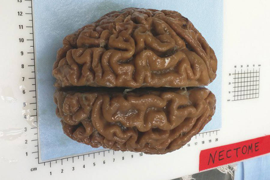 Nectome Human Brain