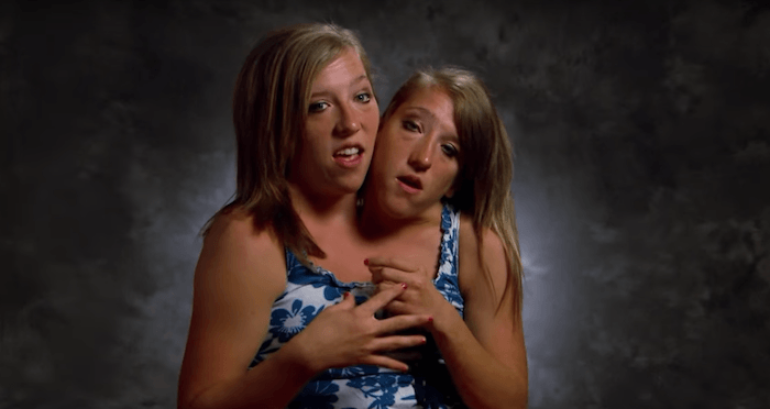 Abigail & Brittany Hensel - The Twins Who Share a Body - video Dailymotion